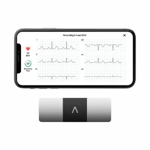 AliveCor KardiaMobile 6-Lead Personal EKG Monitor