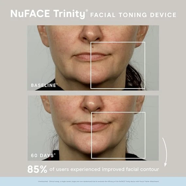NuFACE Trinity Starter Kit 美容儀 3