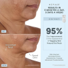 NuFACE TRINITY+ Microcurrent Facial Device 美容儀 5