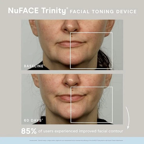 NuFACE Limited-Edition Trinity Microcurrent Skincare Regimen 美容儀 3