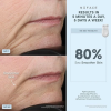 NuFACE FDA Cleared Effective Lip & Eye Attachment for Trinity Microcurrent Facial Device 美容儀配件 4