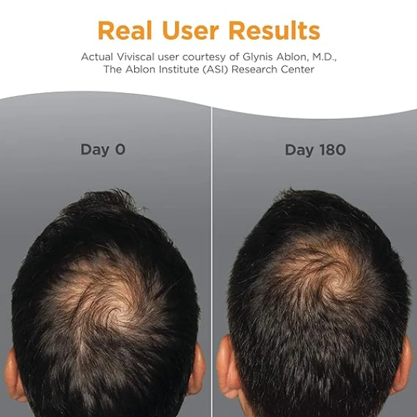 Viviscal Men's Hair Growth Supplements for Thicker 薇絲卡魔髮錠 男用育髮保健品 3