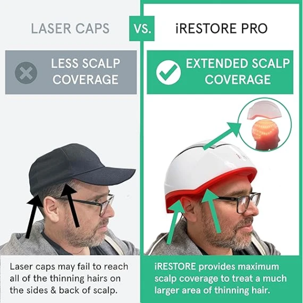 iRestore Professional Laser Hair Growth System + Rechargeable Battery Pack 雷射生髮帽 3