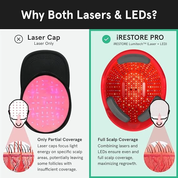 iRestore Professional 282 FDA Cleared Laser Hair Growth Device 雷射生髮帽 3