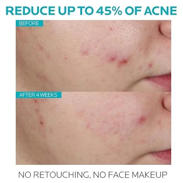 La Roche-Posay Effaclar Salicylic Acid Acne Treatment to Minimize Pores 理膚寶水 精華液 2